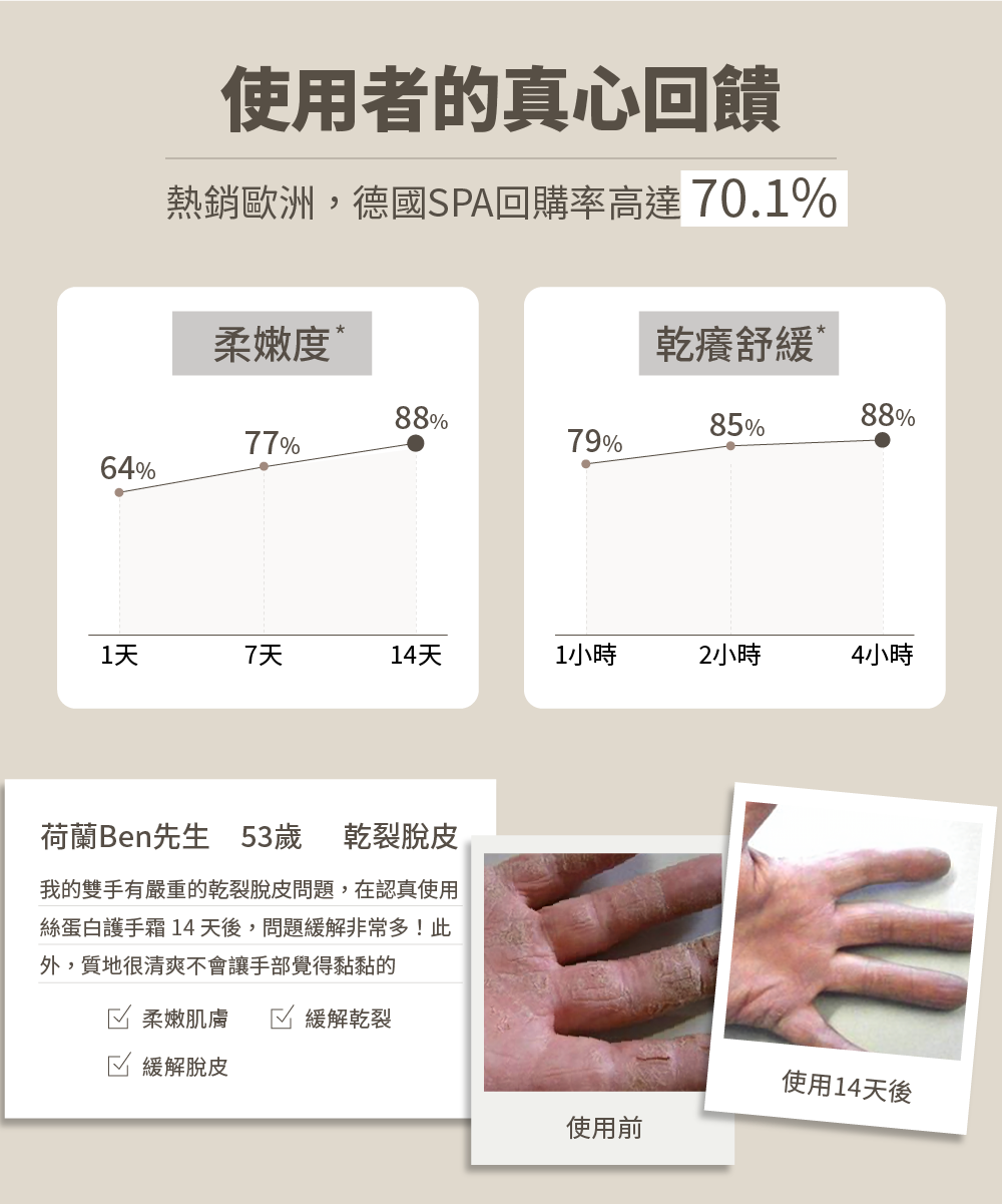 絲蛋白護手霜 14 天後,問題緩解非常多此