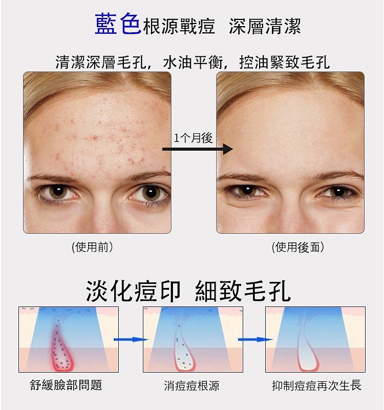 清潔深層毛孔,水油平衡,控油緊致毛孔